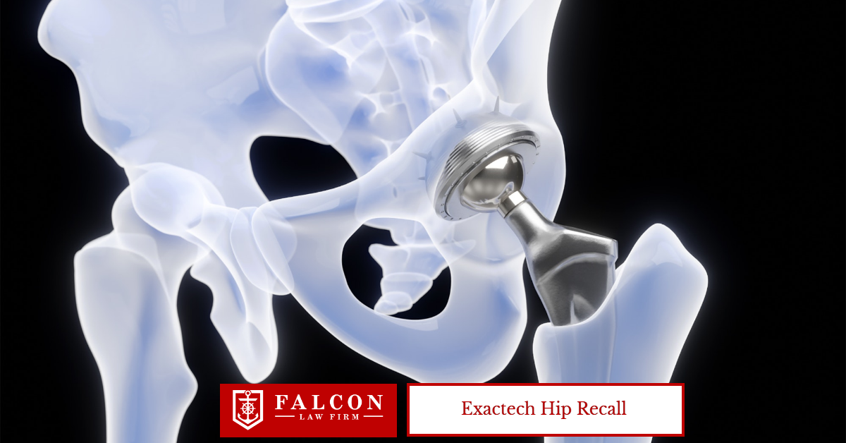 Exactech Hip Recall - Featured Image